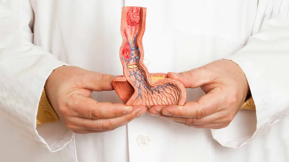 Penis Kanseri Tedavisi